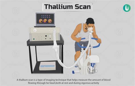 Thallium Scan: Procedure, Purpose, Results, Cost, Price, Online booking