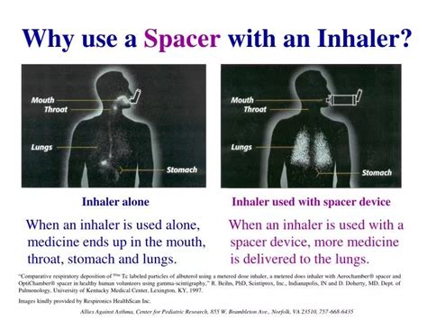 PPT - Why use a Spacer with an Inhaler? PowerPoint Presentation, free ...