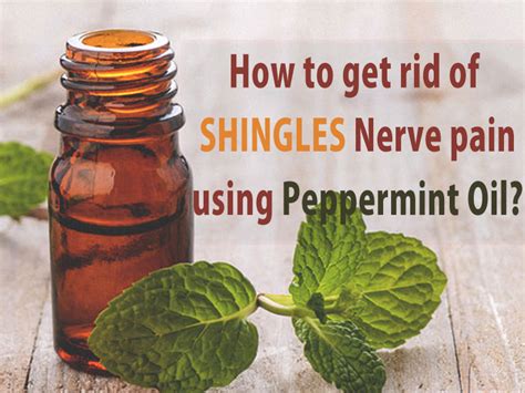 How to get rid of Shingles Nerve pain using Peppermint Oil? - Skin ...