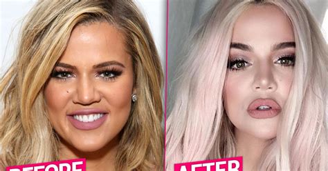 Khloe Kardashian Unrecognizable After Massive Plastic Surgery Makeover