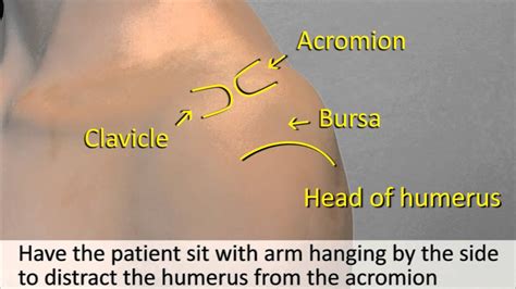 Musculoskeletal Examination and Joint Injection Series_ Subacromial ...