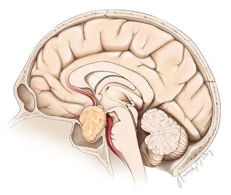 Pituitary Tumor Surgery | Expert Surgeon | Aaron Cohen-Gadol, MD