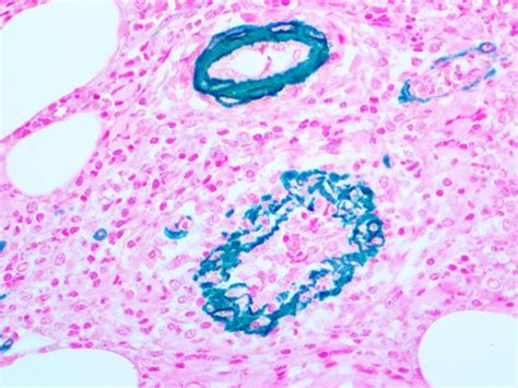 Actin, Smooth Muscle Antibody (BSB-15) - Bio SB