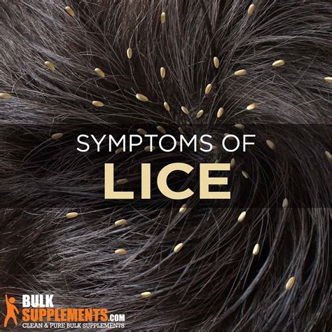 Don't Let Lice Ruin Your Day: Effective Treatment For The Whole Family