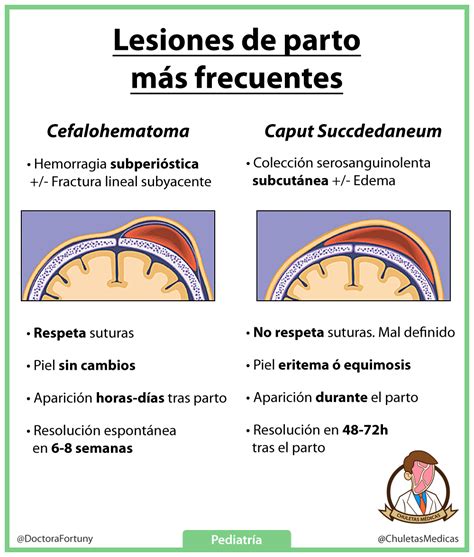 Diferencias entre Cefalohematoma y Caput Succedaneum - Chuletas Médicas