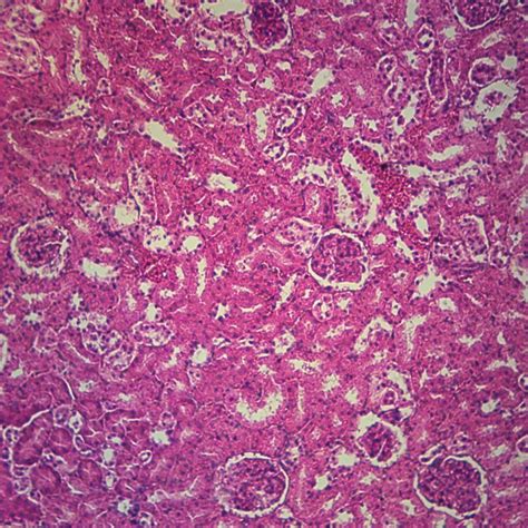 Simple Cuboidal Epithelium Under Microscope Labeled - Micropedia