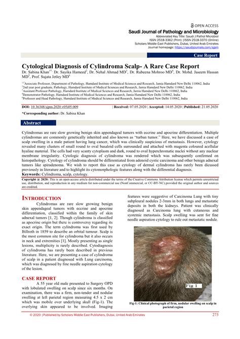 Cytological Diagnosis of Cylindroma Scalp- a Rare Case Report Dr - DocsLib