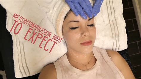 Microdermabrasion 101- What to expect - YouTube