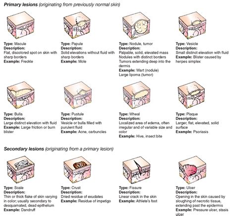 types of lesions | Bilgi