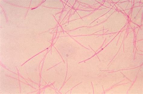 Fusobacterium - wikidoc