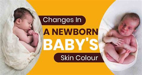 Why A Baby’s Skin Colour Changes - 7 Common Reasons