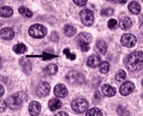 Mitotic Figure Quiz – The Davis-Thompson Foundation