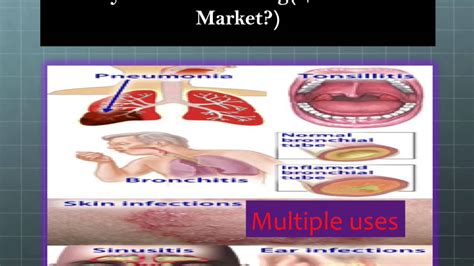 Clarithromycin - YouTube