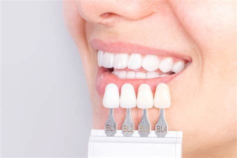 Everything You Should Know About Porcelain Crowns | Aria Dental