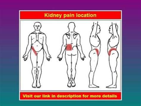 Kidney Pain Location