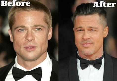 Brad Pitt before and after plastic surgery (14) – Celebrity plastic ...