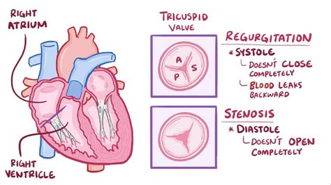 Tricuspid Valve: Overview, Function And Anatomy, 50% OFF