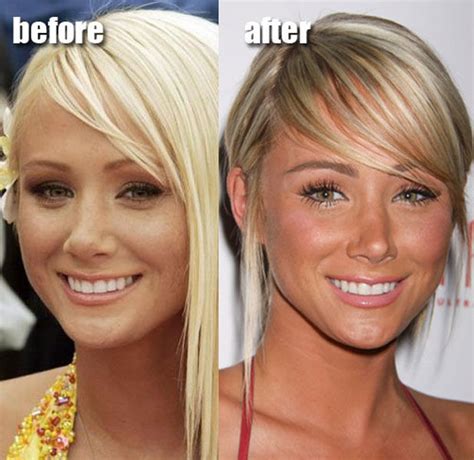 Celebrity Plastic Surgery Before & After (56 pics) - Izismile.com