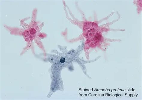 Amoeba Proteus Under Microscope Labeled