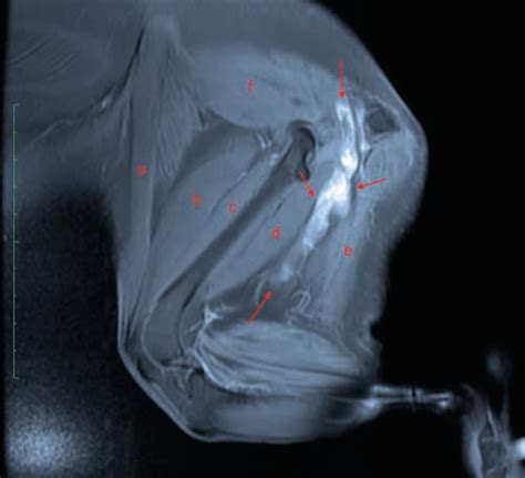 Case Study: The Role of Hemipelvectomy | Veterinary Specialists Auckland