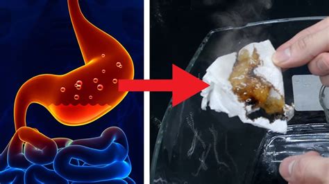 Why Does Excess Stomach Acid Cause Indigestion - PELAJARAN