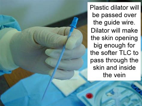 Clinical Notes: Central Line Placement: A Step-by-Step Procedure Guide with Photos