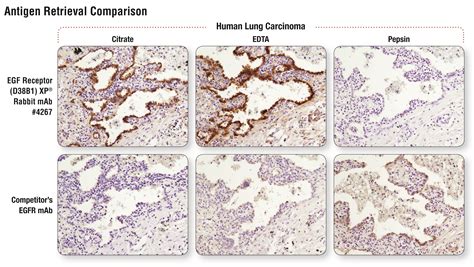 ihc fr vs ihc p