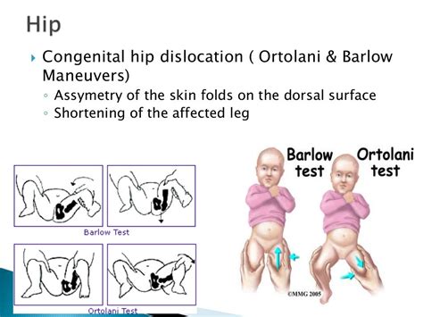 Examination of newborn and Resuscitation