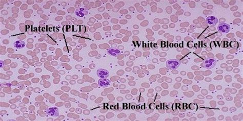 Blood Under Microscope Labeled