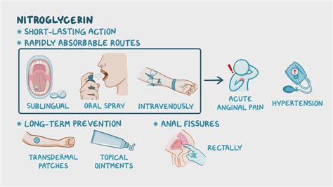 Nitrates: Nursing pharmacology - Osmosis Video Library