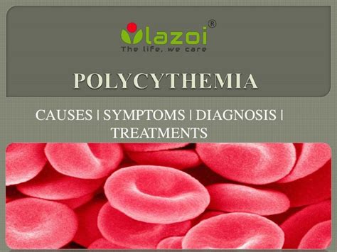 Polycythemia: Causes, symptoms, diagnosis and treatment