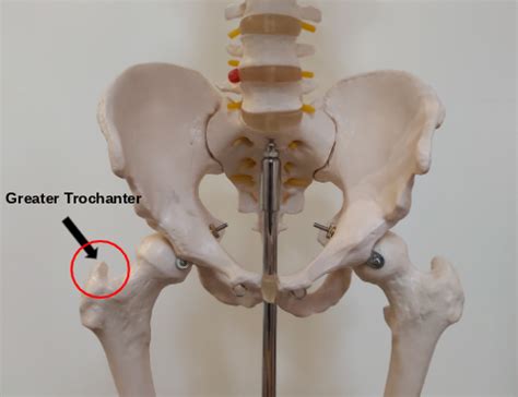 Greater Trochanteric Pain Syndrome: Symptoms, Causes, And, 57% OFF