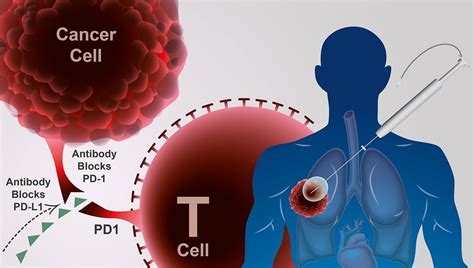 Doctor Develops New Method to Significantly Reduce Cost and Improve ...