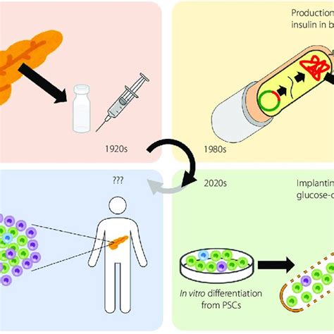 | From purified insulin to b-cell replacement therapy. Insulin therapy... | Download Scientific ...