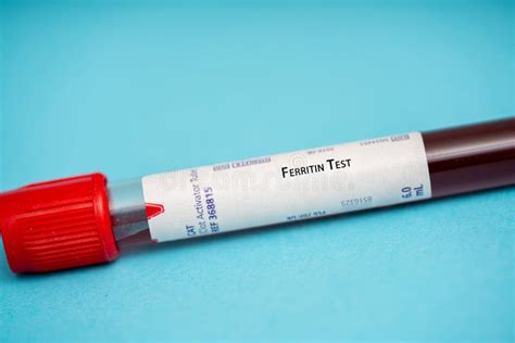 Ferritin Test stock image. Image of ferritin, diagnosis - 275922665