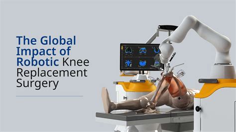 The Global Impact of Robotic Knee Replacement Surgery: