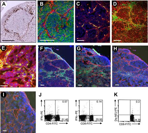 Analysis of tumor-infiltrating cells in human and mouse tumors. (A ...