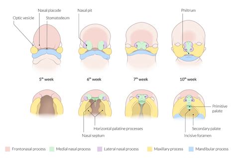 Unilateral Complete Cleft Lip Maxillary | Sitelip.org