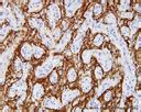 Immunohistochemistry