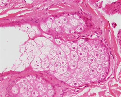 Histología en Imágenes : GLANDULA SEROSA O MUCOSA??