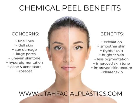 The Benefits of Chemical Peels - Utah Facial Plastics | Chemical peel, Facial peel, Chemical ...