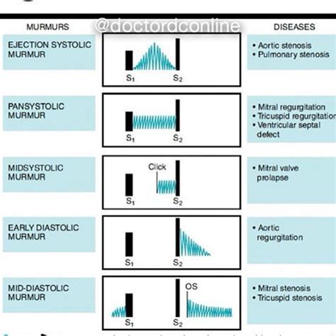 doctordconline: “ Heart Murmur A heart murmur is an extra or unusual sound heard during a ...