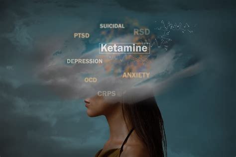 Ketamine Infusion Therapy - GLOBAL MED