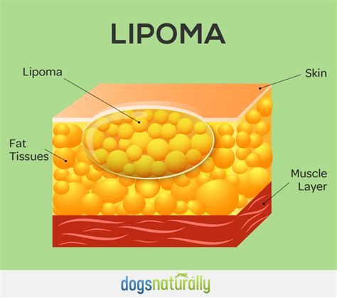 Lipomas In Dogs: 6 Herbs To Get Rid Of Fatty Tumors | Tumors on dogs, Fatty cyst, Tumor