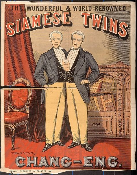 Story of Chang and Eng Bunker - Conjoined Twins - Sometimes Interesting