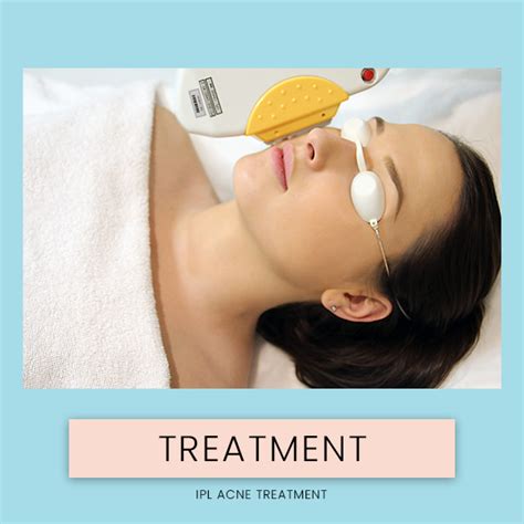 IPL Acne Treatment - Wonderlab