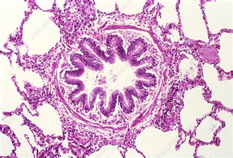 LM of a cross-section of a bronchiole & alveoli - Stock Image P590/0039 - Science Photo Library