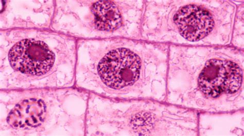 Plant Cell Nucleus Microscope