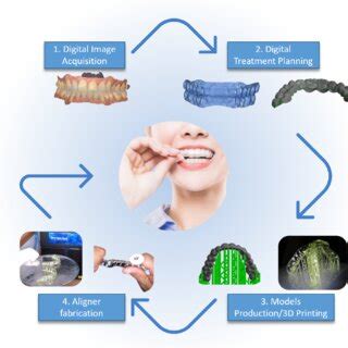 (PDF) Advances in orthodontic clear aligner materials