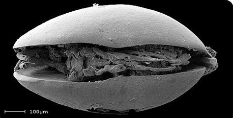 Real Monstrosities: Ostracod